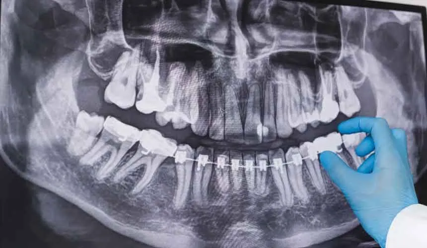 تفسیر رادیوگرافی‌ها 