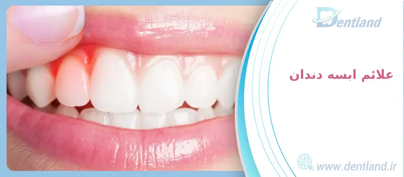 ابسه دندان چیست ؟