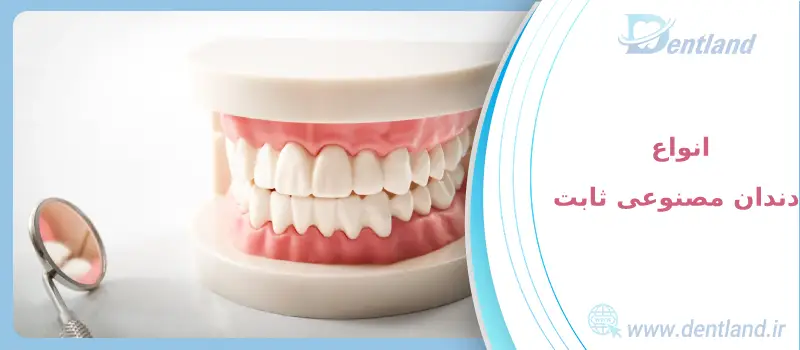 دندان مصنوعی ثابت بهتر است یا متحرک